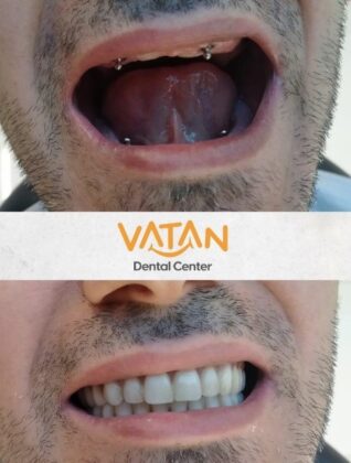 Vatan Dental Center