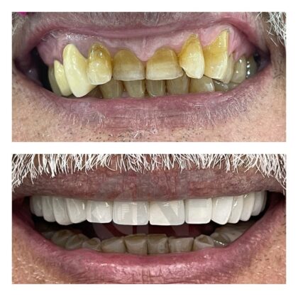 Nifa Dent International
