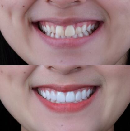 About Tooth Dental Clinic