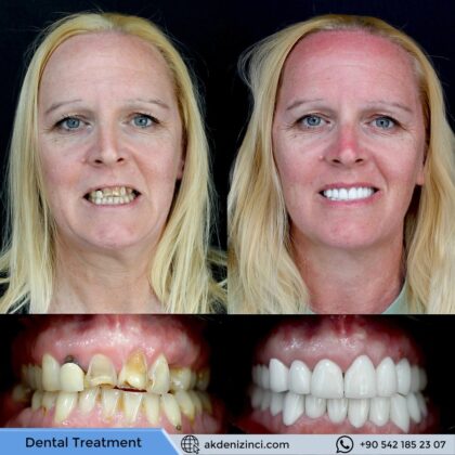 Akdeniz İnci Dental Clinic
