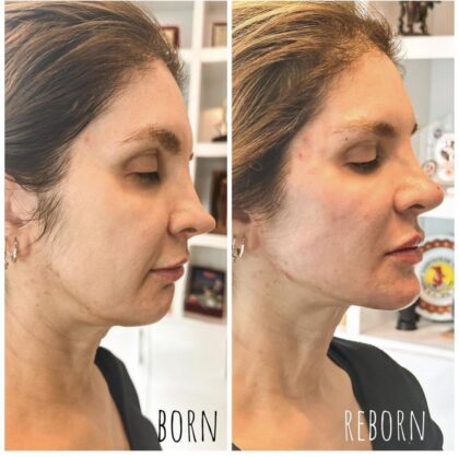 Reborn Clinics
