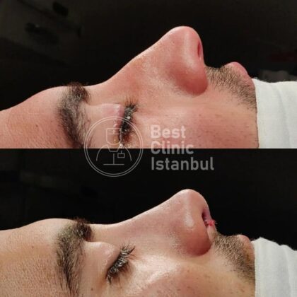 Best Clinic Istanbul