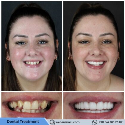Akdeniz İnci Dental Clinic