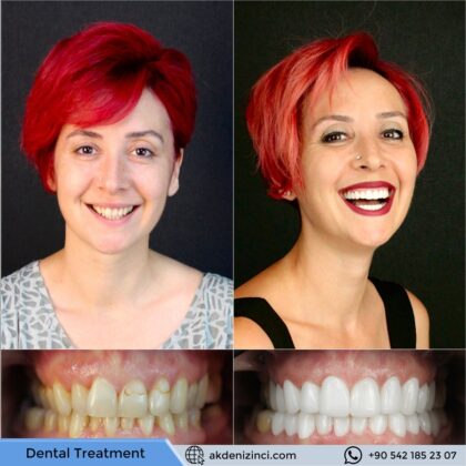 Akdeniz İnci Dental Clinic