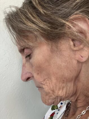 Dr Phatcharasak Kraisornphongsakul Md
