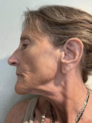 Dr Phatcharasak Kraisornphongsakul Md