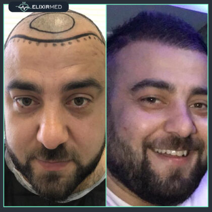 ElixirMed Clinic