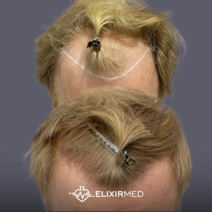 ElixirMed Clinic