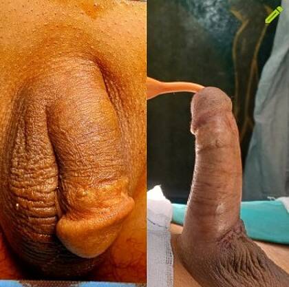 Men’s Health Clinics