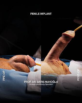 Men’s Health Clinics