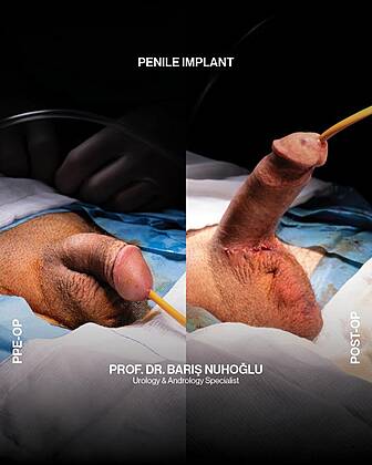 Men’s Health Clinics