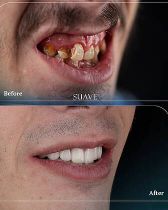 Suave Dental Clinic Suave Dental Clinic