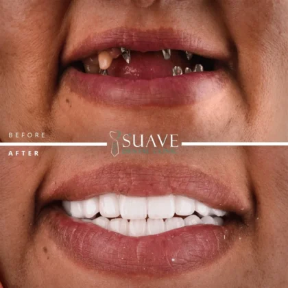 Suave Dental Clinic