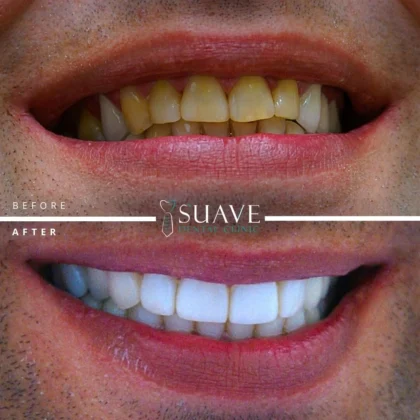 Suave Dental Clinic