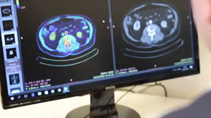 Melanoma Unit Clinica
