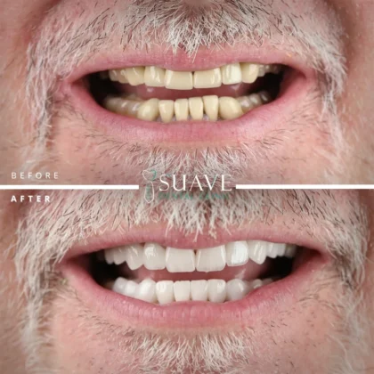Suave Dental Clinic