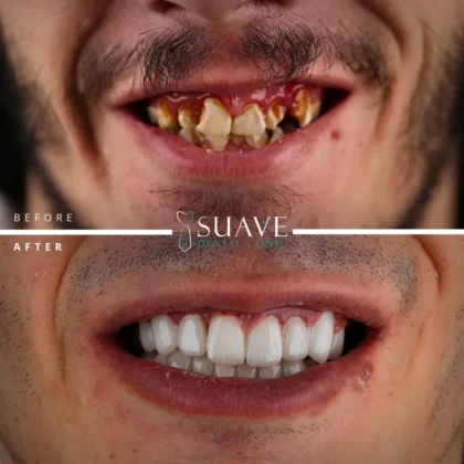 Suave Dental Clinic