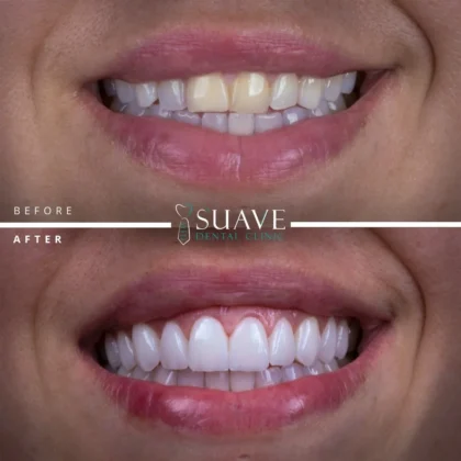 Suave Dental Clinic