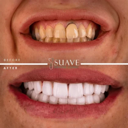 Suave Dental Clinic