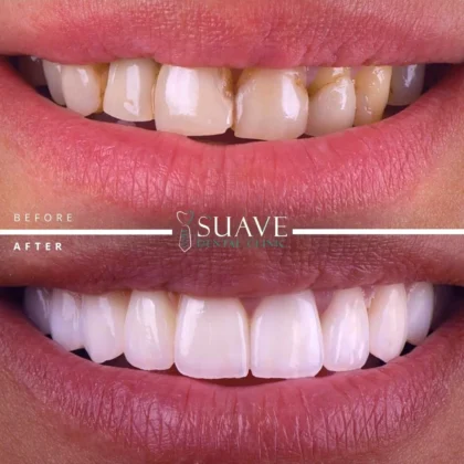 Suave Dental Clinic