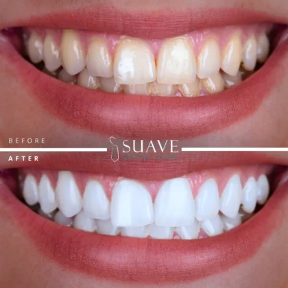Suave Dental Clinic