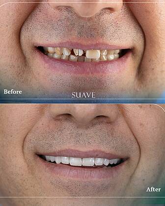 Suave Dental Clinic Suave Dental Clinic