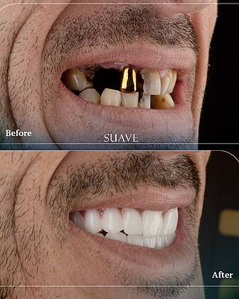 Suave Dental Clinic Suave Dental Clinic