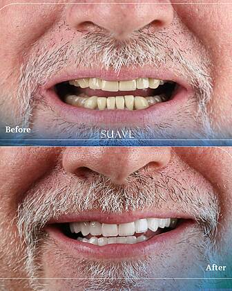 Suave Dental Clinic Suave Dental Clinic