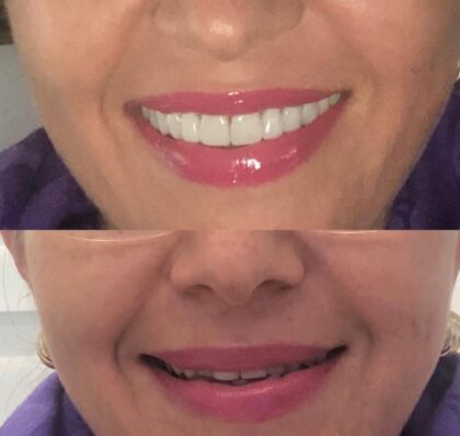 Dental Clinic Smile Design