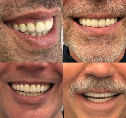 Dental Clinic Smile Design
