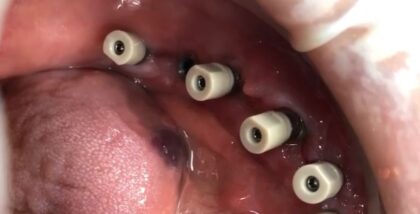 Dental Clinic Smile Design