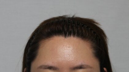 MOAMAN Hair Transplant Clinic