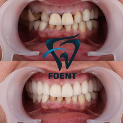 Dent48 Oral and Dental Health Polyclinics
