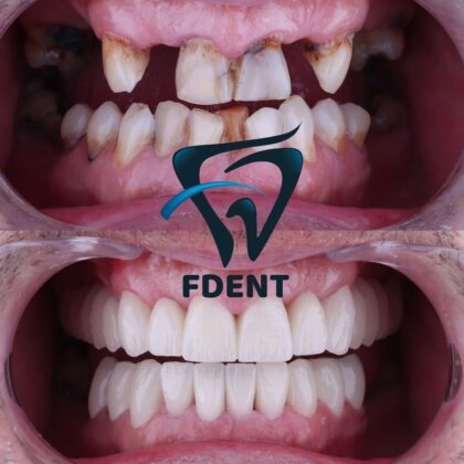 Dent48 Oral and Dental Health Polyclinics