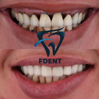 Dent48 Oral and Dental Health Polyclinics