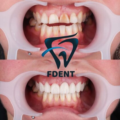 Dent48 Oral and Dental Health Polyclinics
