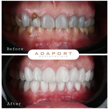 Adaport Dental Clinic