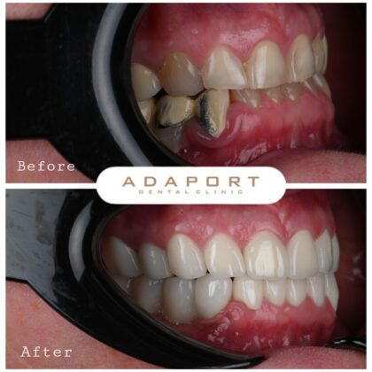 Adaport Dental Clinic