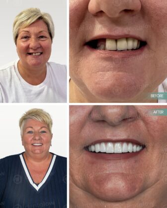 Dent Glow Clinic