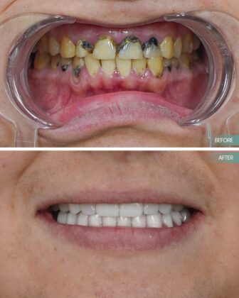Dent Glow Clinic