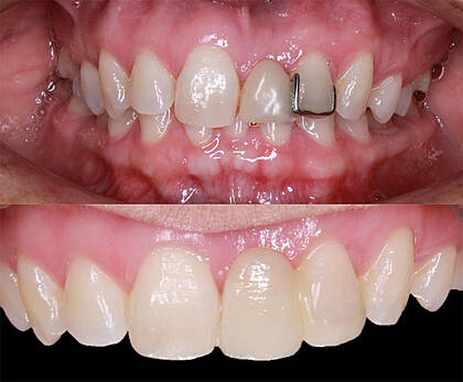 Quality International Dental Clinic