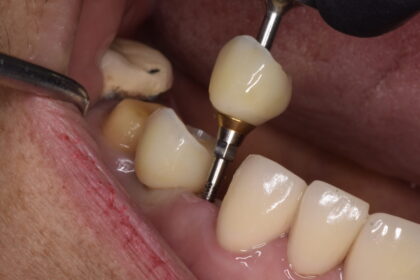 Teethsavers Dental Clinic