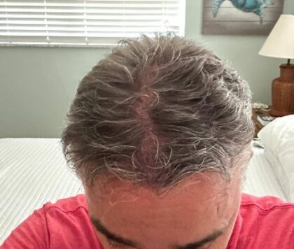 MedArt Hair