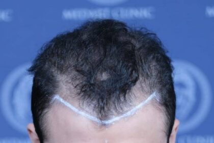 MedArt Hair