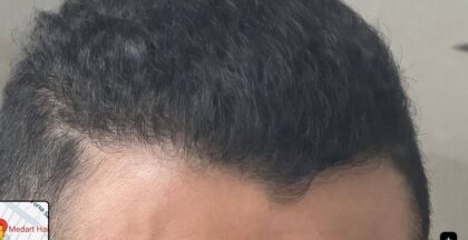 MedArt Hair