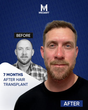 MedArt Hair