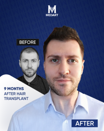 MedArt Hair