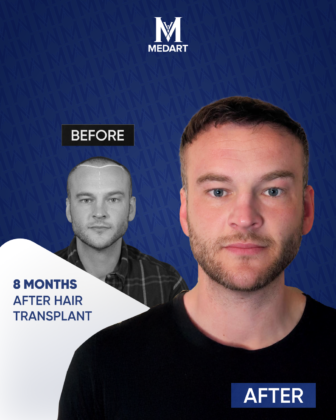 MedArt Hair