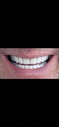 YeahSmile