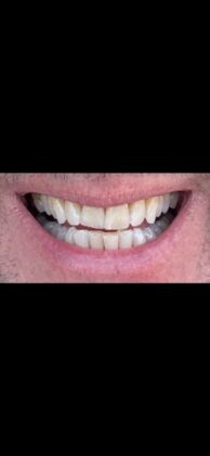 YeahSmile